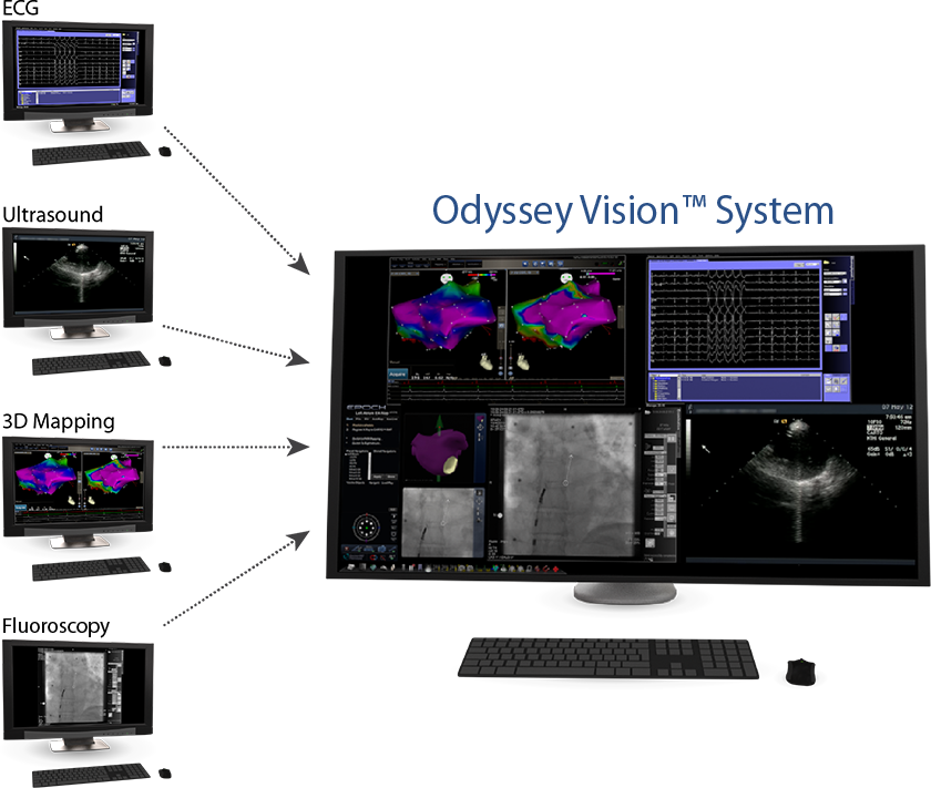 Odyssey Vision Stereotaxis Product