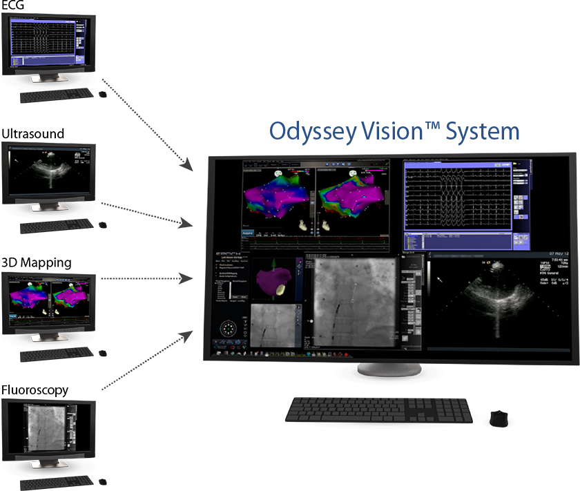 Odyssey-Vision-System Odyssey Vision Stereotaxis Product